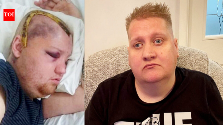 UK Man Sues NHS for Eight Years of Unnecessary Chemotherapy